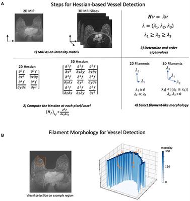 Vascularity and Dynamic Contrast-Enhanced Breast Magnetic Resonance Imaging